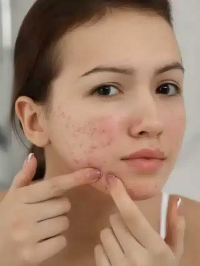Wonderful face cleansers for pimples and black spots