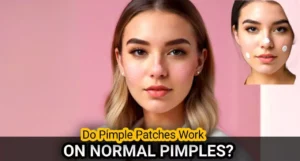 Do pimple patches work on unpopped pimples?