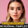 Do pimple patches work on unpopped pimples?